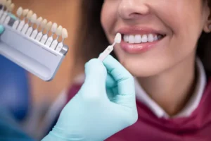 Dental Veneers for Missing Teeth