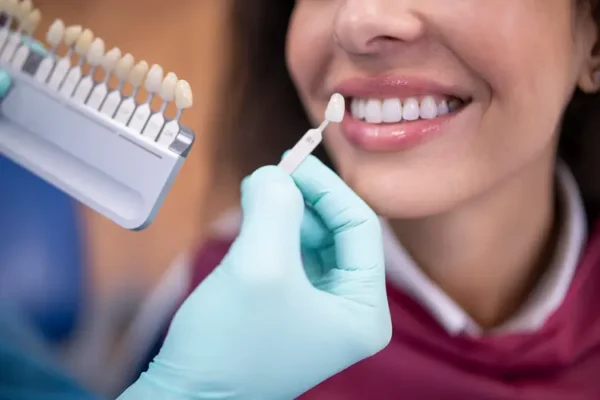 Dental Veneers for Missing Teeth